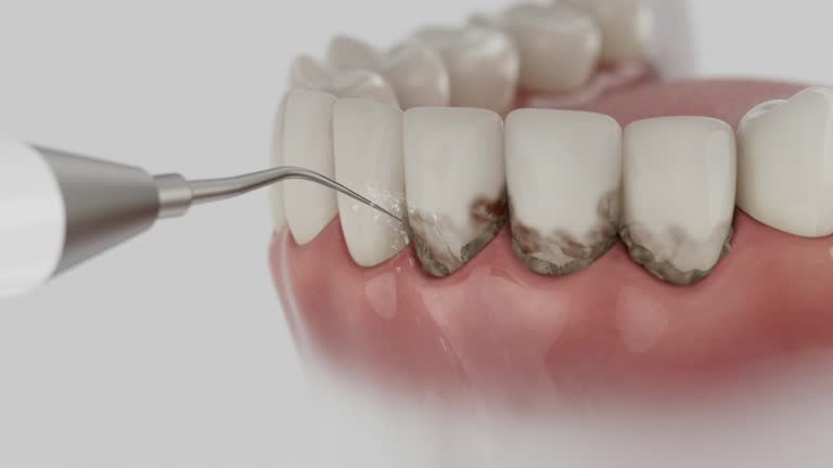 Trusted Dental Crowns And Bridges service in Tunica, MS - Dentist Open Now